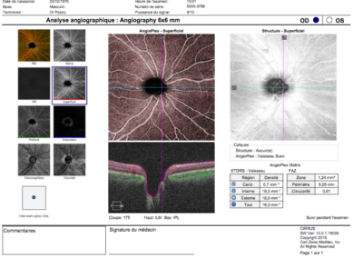 Analyse angiographique
