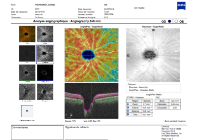 Analyse angiographique