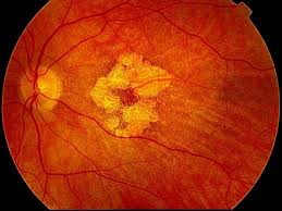 bilan vision